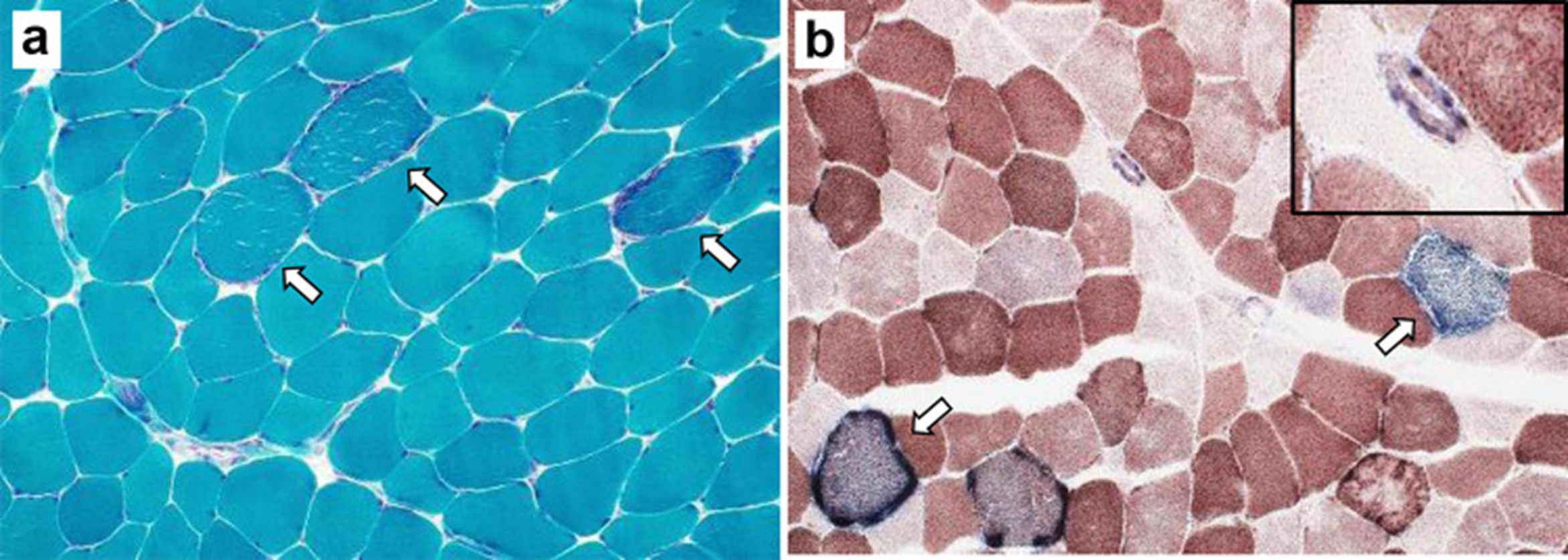 【佳学基因检测